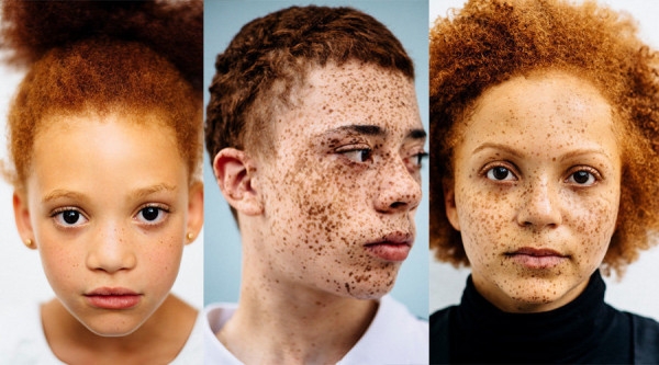 Photographer Documents Beautiful Diversity of Redheads of African Descent