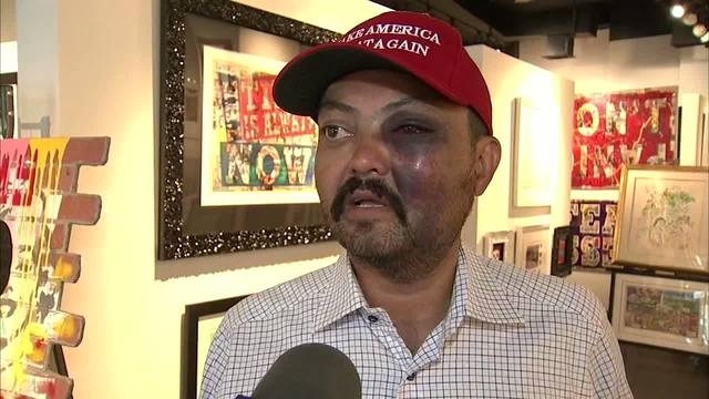 Man says he was beaten in NYC for wearing MAGA hat