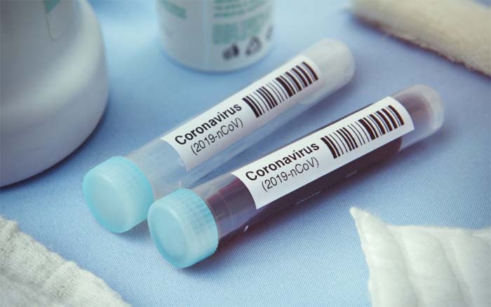 U.S. Government Signs $450 Million COVID-19 Vaccine Contract With Johnson & Johnson