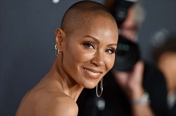Jada Pinkett Smith Embraces Hair Loss: ‘Me and This Alopecia Are Going to Be Friends’
